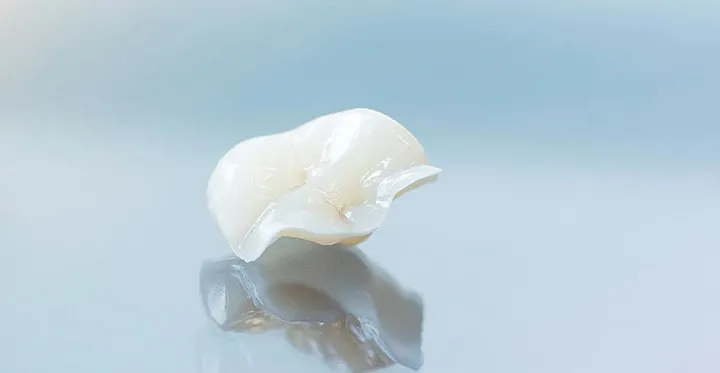 自然な仕上がりの補綴物による審美治療